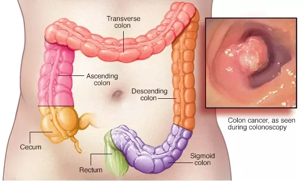 How Colon Hydrotherapy machine work 2